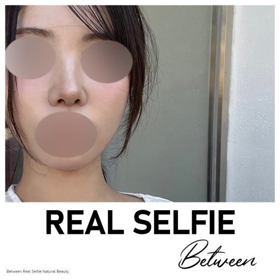 비…